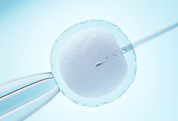 In Vitro Fertilization (IVF